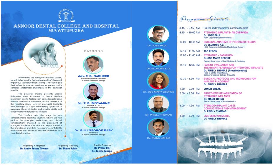 EXPLORING NEW HORIZONS IN DENTAL IMPLANTOLOGY – PTERYGOID IMPLANTS